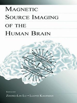 Magnetic Source Imaging of the Human Brain