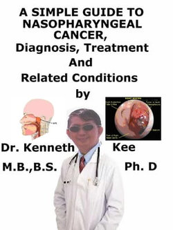 A Simple Guide to Nasopharyngeal Cancer, Diagnosis, Treatment, and Related Conditions