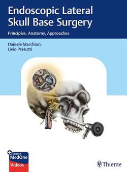 Endoscopic Lateral Skull Base Surgery