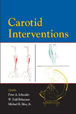 Carotid Interventions