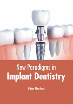 New Paradigms in Implant Dentistry