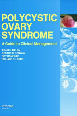 Polycystic Ovary Syndrome