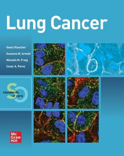 Lung Cancer: Standards of Care