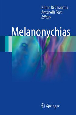 Melanonychias