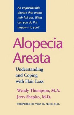 Alopecia Areata