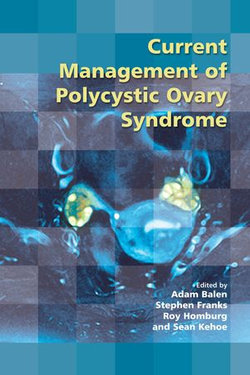 Current Management of Polycystic Ovary Syndrome