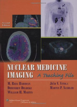 Nuclear Medicine Imaging