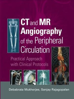 CT and MR Angiography of the Peripheral Circulation