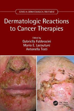 Dermatologic Reactions to Cancer Therapies