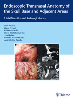 Endoscopic Transnasal Anatomy of the Skull Base and Adjacent Areas