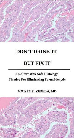 Don't Drink It But Fix It: An Alternative Safe Histology Fixative For Eliminating Formaldehyde