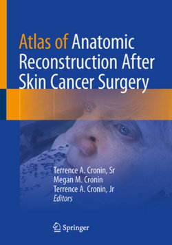 Atlas of Anatomic Reconstruction after Skin Cancer Surgery