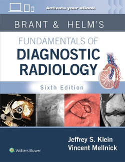 Brant and Helm's Fundamentals of Diagnostic Radiology: Print + EBook with Multimedia