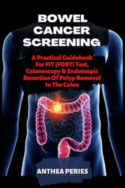 Bowel Cancer Screening: A Practical Guidebook For FIT (FOBT) Test, Colonoscopy & Endoscopic Resection Of Polyp Removal In The Colon