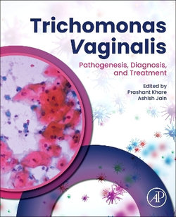 Trichomonas Vaginalis