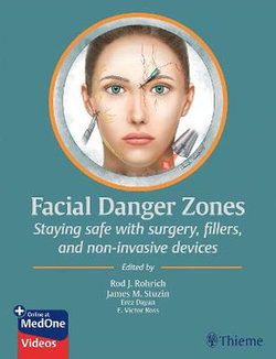 Facial Danger Zones