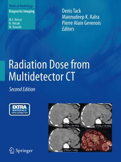 Radiation Dose from Multidetector CT