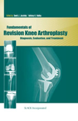 Fundamentals of Revision Knee Arthroplasty