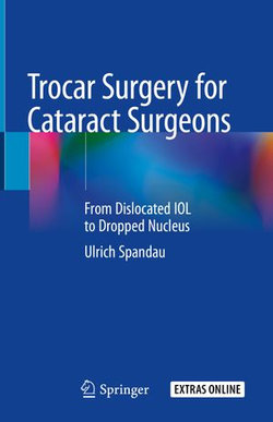 Trocar Surgery for Cataract Surgeons