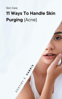 Skin Care: 11 Ways To Handle Skin Purging (Acne)