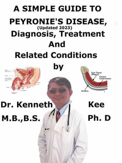 A Simple Guide to Peyronie’s Disease, (Updated 2023) Diagnosis, Treatment and Related Conditions