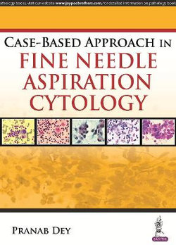 Case-Based Approach in Fine Needle Aspiration Cytology