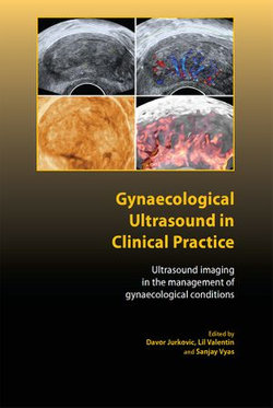 Gynaecological Ultrasound in Clinical Practice