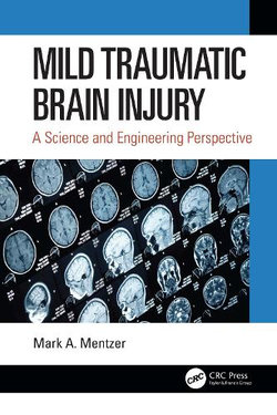 Mild Traumatic Brain Injury