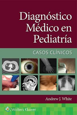 Diagnóstico Médico en Pediatría