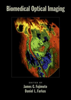 Biomedical Optical Imaging