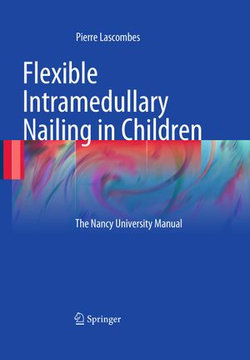 Flexible Intramedullary Nailing in Children