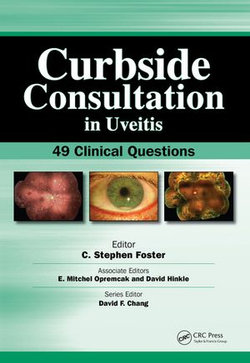 Curbside Consultation in Uveitis