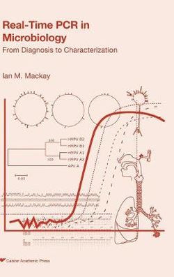 Real-time PCR in Microbiology