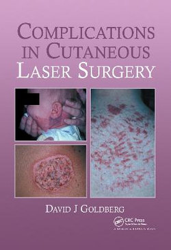 Complications in Laser Cutaneous Surgery