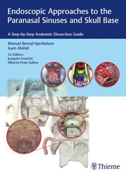 Endoscopic Approaches to the Paranasal Sinuses and Skull Base