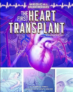 The First Heart Transplant