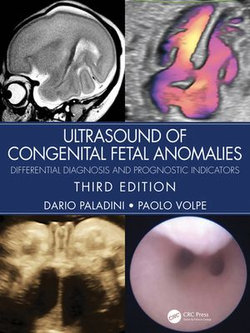 Ultrasound of Congenital Fetal Anomalies