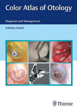 Color Atlas of Otology