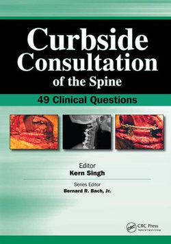 Curbside Consultation of the Spine