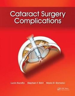 Cataract Surgery Complications