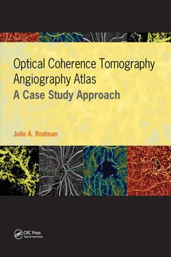 Optical Coherence Tomography Angiography Atlas