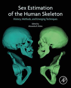 Sex Estimation of the Human Skeleton