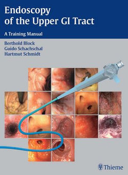 Endoscopy of the Upper GI Tract