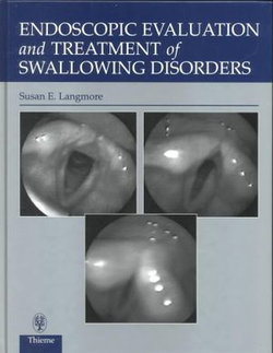 Endoscopic Evaluation and Treatment of Swallowing Disorders