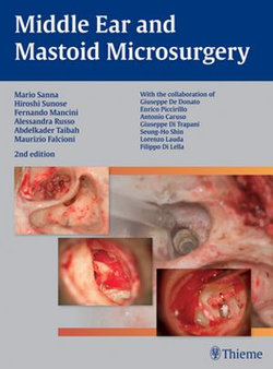 Middle Ear and Mastoid Microsurgery