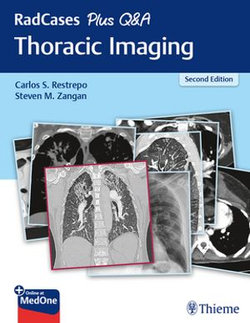 RadCases Plus Q&A Thoracic Imaging