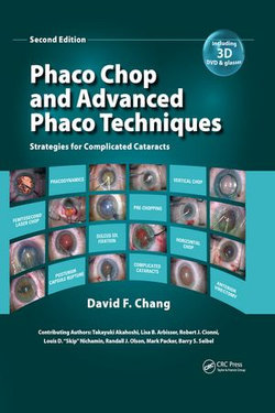 Phaco Chop and Advanced Phaco Techniques