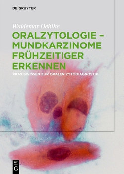 Oralzytologie - Mundkarzinome Frühzeitiger Erkennen