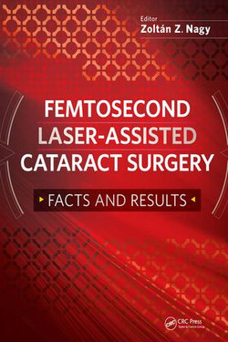 Femtosecond Laser-Assisted Cataract Surgery