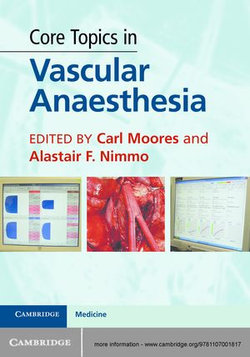 Core Topics in Vascular Anaesthesia